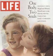Because they have two brains, each twin controls one side of the body, and can only feel sensations on their respective side. Abby Brittany Hensel The Famous Conjoined Twins Where Are They Now