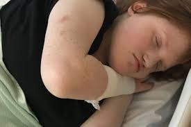 Fundraiser by Jodie Dean : Carmens fund for bed