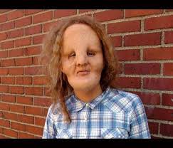 But she was the perfect mother for rocky. 12 Rocky Dennis Ideas Rocky Dennis Human Oddities