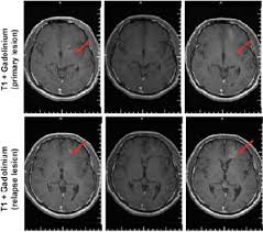 نتیجه جستجوی لغت [inoperable] در گوگل