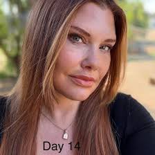 Grateful to highlight her remarkable beauty with #EspinoLift — where  precision meets elegance. She kindly shared her own photos to show her  journey. #nomakeup just her own beauty! Don't forget to follow