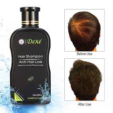 Chinese herbal remedies for hair loss you may try. 200ml Dexe Hair Shampoo Anti Hair Loss Chinese Herbal Hair Growth Anti Dandruff Hair Shampoo Chinese Medicine Shampoo Wish