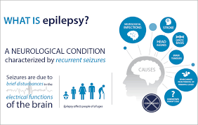 Often these people may just become slightly unfocused and. Who Infographics On Epilepsy