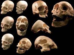 Skull Reference Jpg 1600 1200 Skull Reference Human Skull Skull