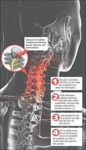 En del av skiven mellom to virvler i nakken har glidd ut og trykker på nervevevet i nakken. Ekspertenes Rad Etter Mette Marits Operasjon Egeninnsats Det Viktigste Na Vg