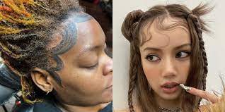 おでこに“産毛”風タトゥーを入れた女性に「絶対後悔する」と賛否……理想の髪型は美容院ではなくタトゥーで手に入れる時代？