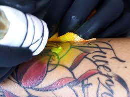 Then a powerful pulse of energy is applied to the tattoo to heat and shatter the tattoo ink. Why It S Hard For People Of Color To Get Great Tattoos