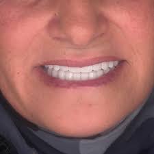 Instagram photo by dr.faisal alkhalaf • Apr 17, 2025 at 5:53 AM