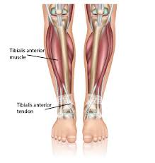 Ligaments are structurally similar to tendons that connect bones to other bones and tightly bind bones together and resist stress. Ankle Tendonitis Anterior Tibial Tendonitis
