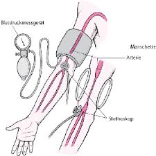 Bluthochdruck Herz Und Gefasskrankheiten Msd Manual Ausgabe Fur Patienten
