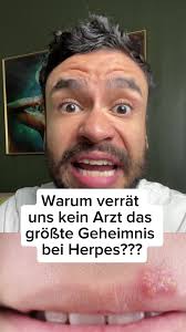 Größtes Geheimnis bei Herpes??? #geheimnis #herpes #gesundheitstipps  #aufklärung #lernenmittiktok