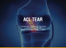 The anterior cruciate ligament (or acl) is one of the primary ligaments in the knee joint. Common Training Injuries And How To Treat Them Acl Tear Fight Quality