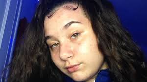 Boston police ask for help finding missing 15-year-old Hyde Park girl