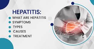 Image result for hepatitis symptoms