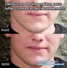 Epingle Sur Beaute