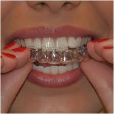 My dentist definitely did a great job buffing and smoothening out the surfaces of my teeth after removing the. Weight Loss And Fitness How To Whiten Teeth With Braces
