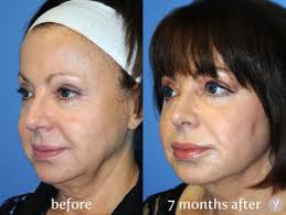 Gae Rodke, Md, Facog, спа-салон, штат Нью-Йорк, район Манхэттен, авеню Вест  Энд — Яндекс Карты