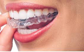 Harga braces meningkat saban tahun. Nad S Braces Journey Before Decide Pakai Braces Hukum Jenis Dan Harga Braces Pengedar Shaklee Kedai Vitamin Bandar Baru Bangi