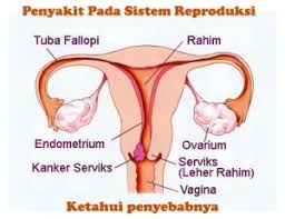 Upaya yang harus dilakukan agar tidak terkena gangguan penyakit pada sistem reproduksi manusia. Penyakit Pada Sistem Reproduksi Pada Manusia Science Education