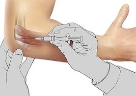 Image result for Elbow Joint Injection