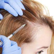 8 (dht stands for dihydrotestosterone, a hormone that has been linked to hair loss. Alopecia Hair Loss