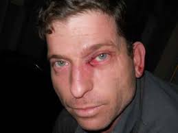 Altercaţie: Un taximetrist de la „Daniel” Taxi i-a învineţit ochiul,  dintr-un pumn, unui coleg de la o firmă concurentă