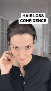 Wearing alternative hair has never been JUST about hair. It's about so much  more. , Do you agree? Comment below 👇, JESS IS WEARING // DARK SUNSET  ILLUSION LACE TOPPER , ., ., ., #thinninghair ...