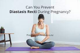 Many experts recommend these diastasis recti exercises during pregnancy in order to help prevent ab separation. Can You Prevent Diastasis Recti During Pregnancy Pregnancy