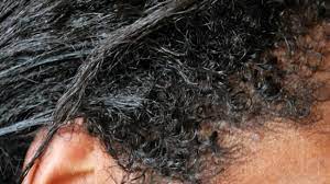 After shampooing your hair, apply the moisturizer to wet or slightly damp hair for best results. How To Care For Dry Hair While You Transition Naturallycurly Com