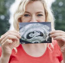Ultraschall In Der Schwangerschaft Babykino Wird Untersagt Welt