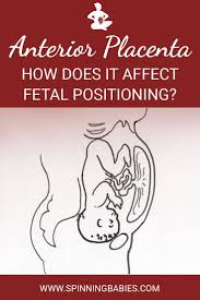 Anterior Placenta What It Means For You And Your Baby Spinning Babies Anterior Placenta Placenta Spinning Babies