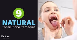 Check spelling or type a new query. Tonsil Stones Causes Symptoms And Treatment Options Dr Axe