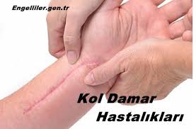 Engelliler Gen Tr Engelli Haklari Ve Sosyal Sorunlar