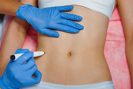 Body Fillers – Dr. Amina Al Amiri Clinic