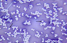 It is a facultative anaerobe, it can therefore use alcoholic fermentation under low oxygen conditions or use. Avq2saulwbmtcm