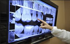 We did not find results for: Xrays Carleton Square Dental Centre