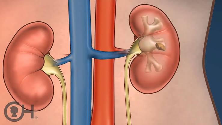 Image result for kidney"