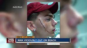 Woman slashed man in face on Clearwater Beach