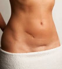 Pin On Weight Loss