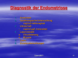 Falls spezifische symptome auftreten, sind es die für eine endometriose typischen beschwerden. Atiologie Und Diagnostik Der Endometriose Ppt Video Online Herunterladen