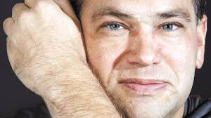 The significance of scars: Marks are physical, emotional