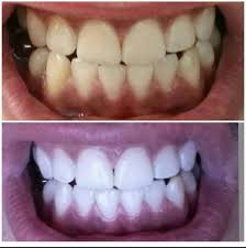 Profile for Pro Whitening