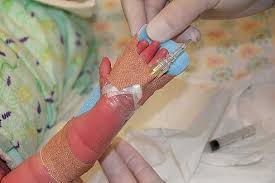 Image result for Difficult Intravenous Access in Children