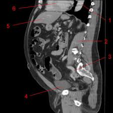Mri patterns of neuromuscular disease involvement thigh & other muscles 2. Atlas Of Ct Anatomy Of The Abdomen W Radiology