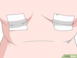 Mix one tablespoon of vinegar into one quart of lukewarm water. Intertrigo Behandeln Wikihow