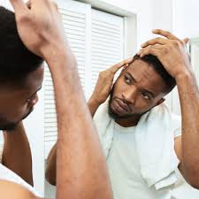We're centrally located in the heart of stafford, and north houston texas. Ever Wondered The Causes Of Hair Loss Houston Tx