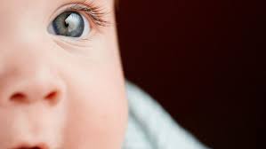Color De Ojos Del Bebe Cuando Se Define