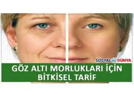 Goz Alti Morluklari Icin Bitkisel Tarifler Bitkisel Tarifler Videolar Gozler