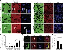 Tau Protein Disrupts Nucleocytoplasmic Transport in Alzheimer's Disease