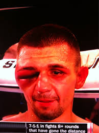 Should this dude really be giving a long post fight interv…